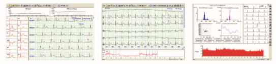 ECG holter software