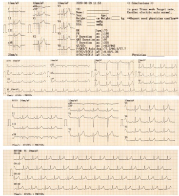 EKG-312T Paper