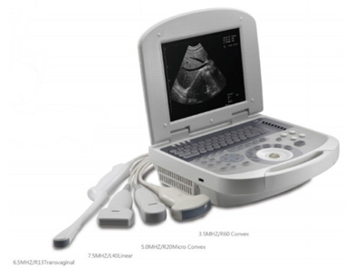 Notebook Ultrasound scanner