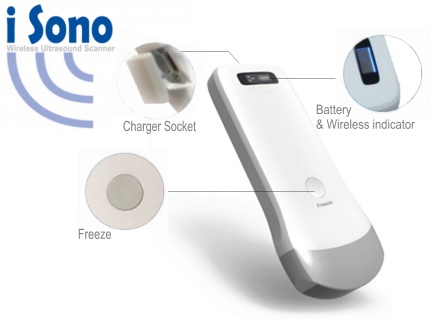 iSono wireless ultrasound