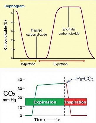 capnometers, which are quantitative and measure the partial pressure (or %) of CO2 in expired air (rather than pH). The advantage is that CIS capnometers can give more than a “yes or no” answer. They provide a number as well as a waveform (“capnography”),