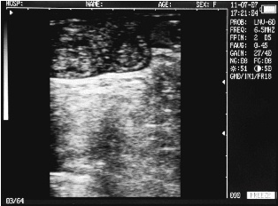 Sonovet ultrasound Scanner