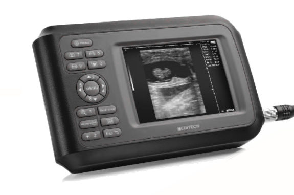 SonoR ultrasound