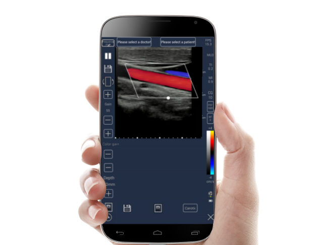 mobile Ultrasound