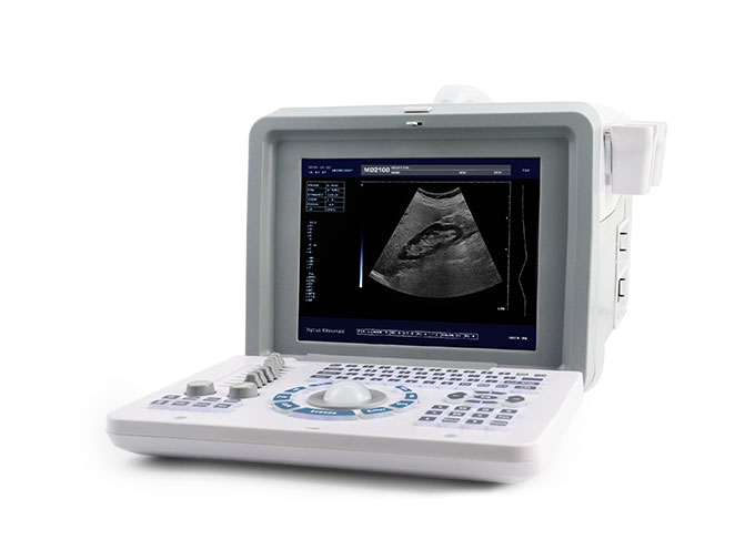 B/W ultrasound scanner