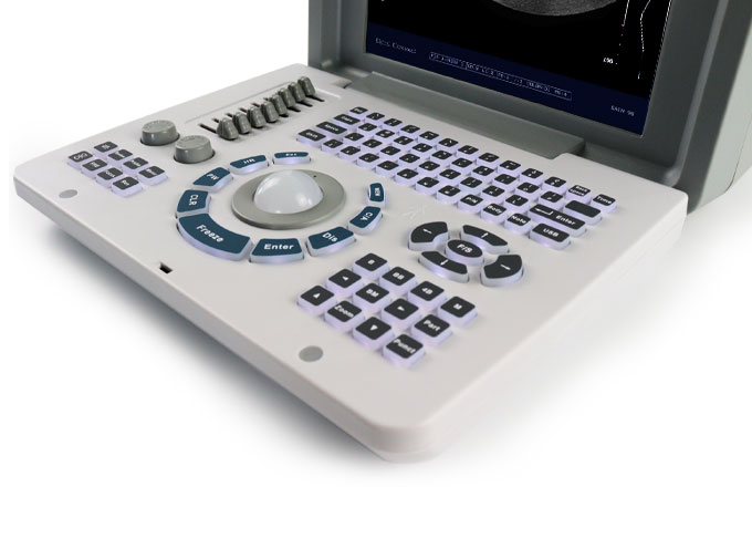 B/W ultrasound scanner