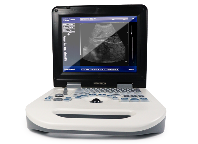 Dolphi-S Ultrasound Scanner