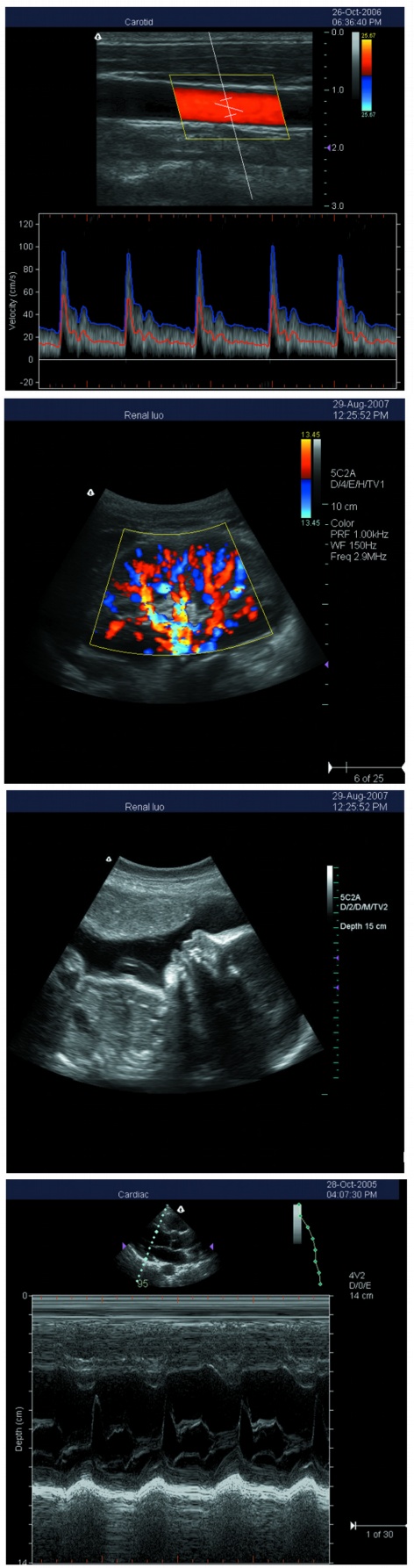 S5i ultrasound Scanner S5i ultrasound Scanner