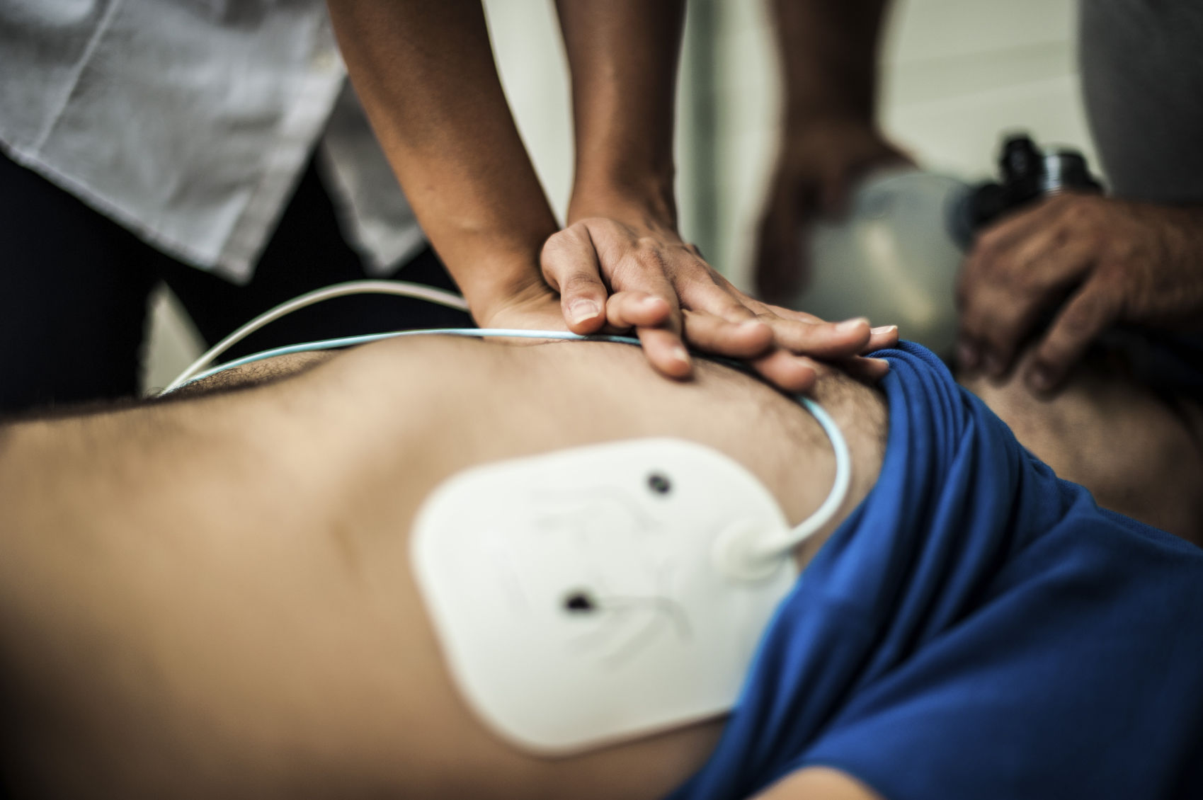 Mono vs Biphasic Defibrillation Waveforms