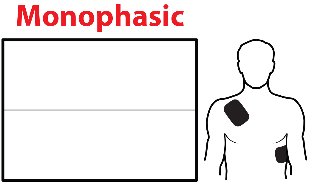 Monophasic defibrillation animation